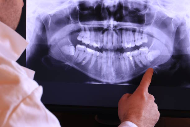 Best Emergency Treatment for Dental Infections or Abscesses in Wailua Homesteads, HI